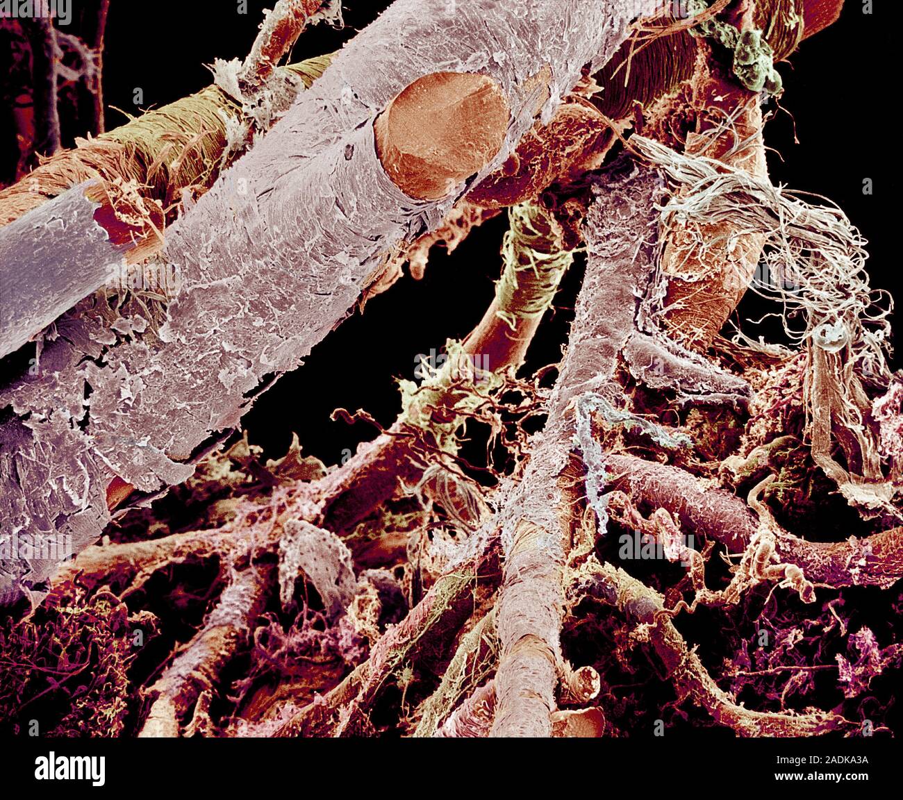 Blood vessels. Coloured scanning electron micrograph (SEM) of a resin ...