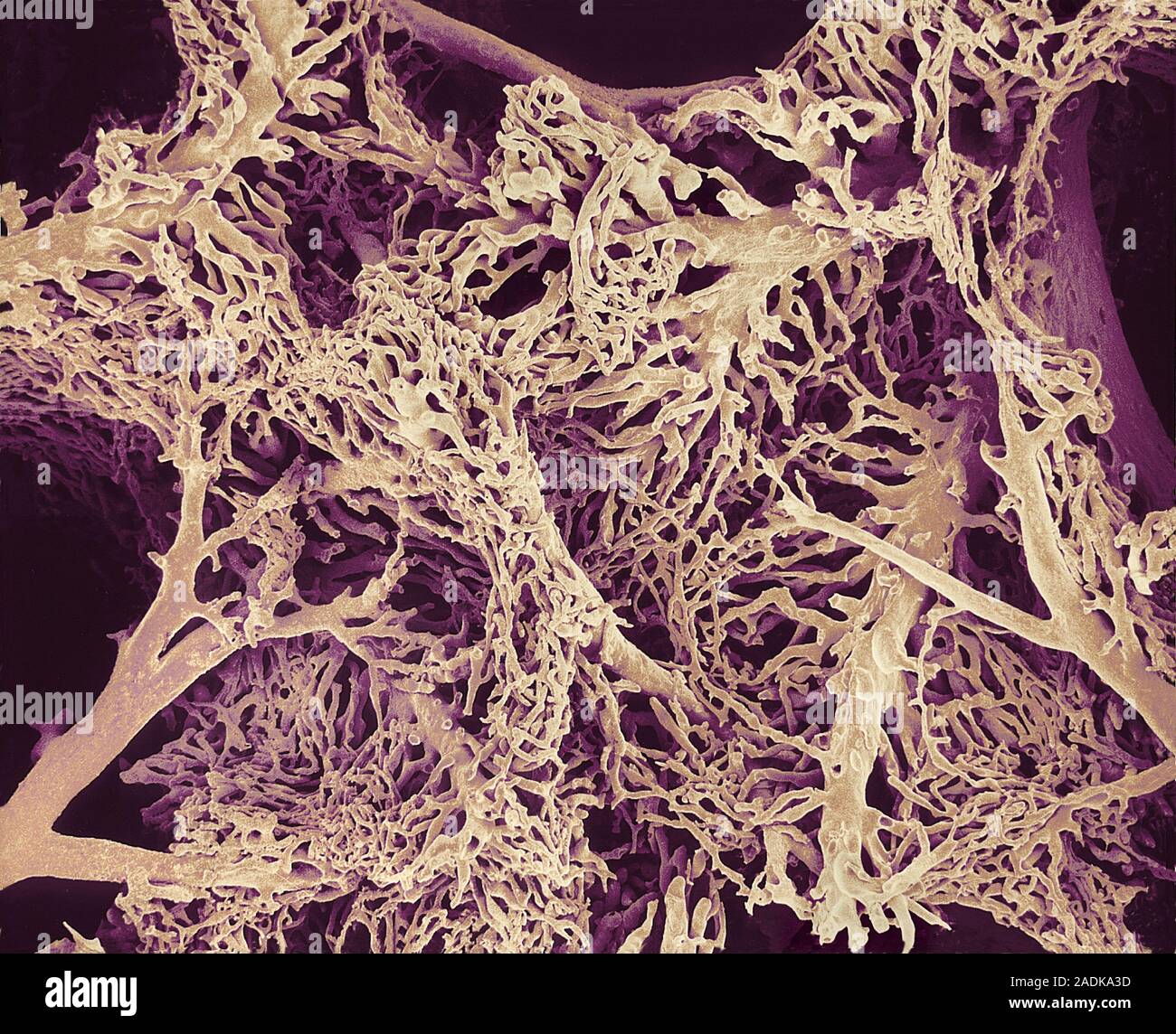 Liver blood vessels. Coloured scanning electron micrograph (SEM) of a ...