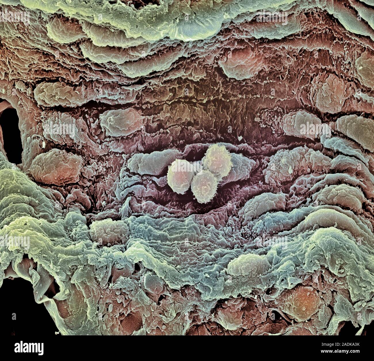 Blood vessel. Coloured scanning electron micrograph (SEM) of a freeze ...