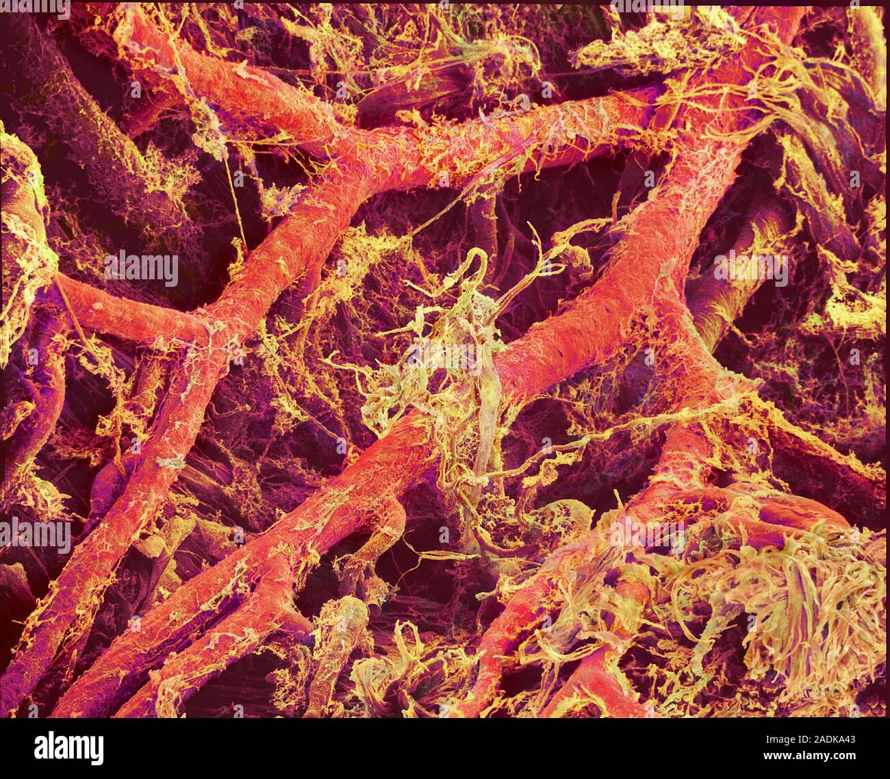 Blood vessels. Coloured scanning electron micrograph (SEM) of a resin ...