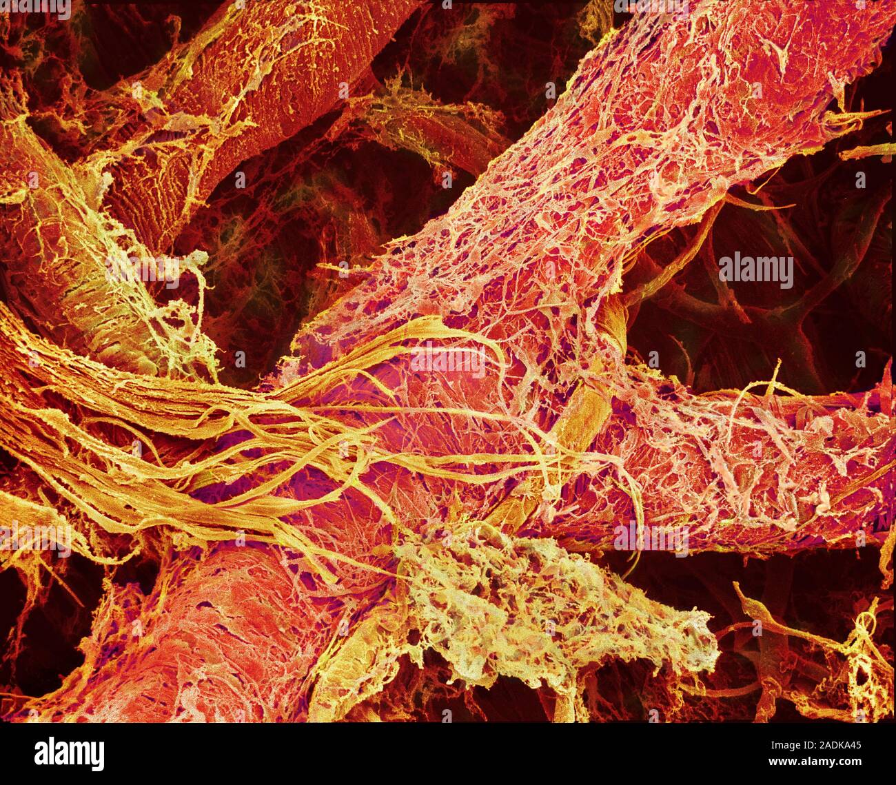 Blood vessels. Coloured scanning electron micrograph (SEM) of a resin ...