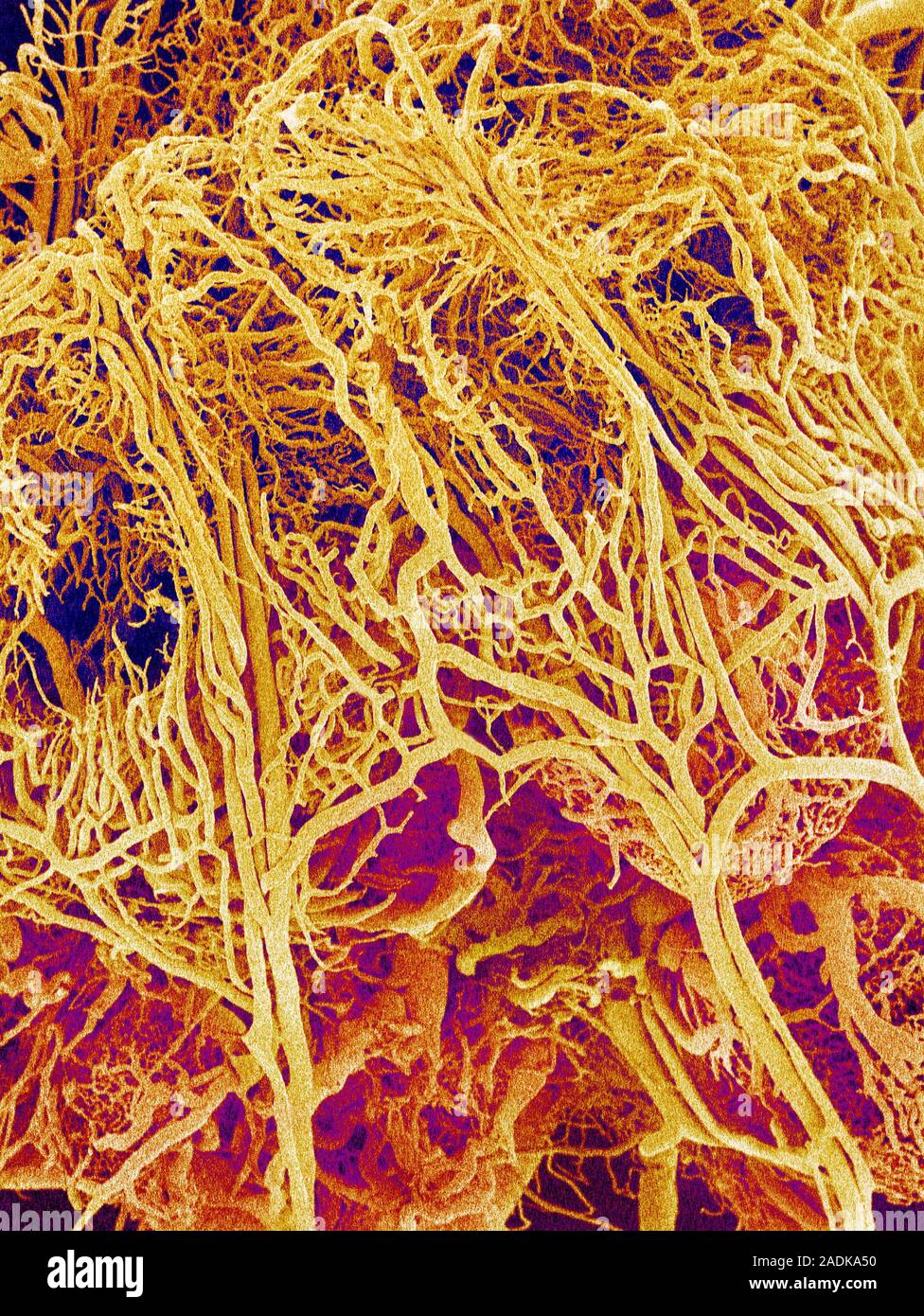 Blood vessels. Coloured scanning electron micrograph (SEM) of a resin ...