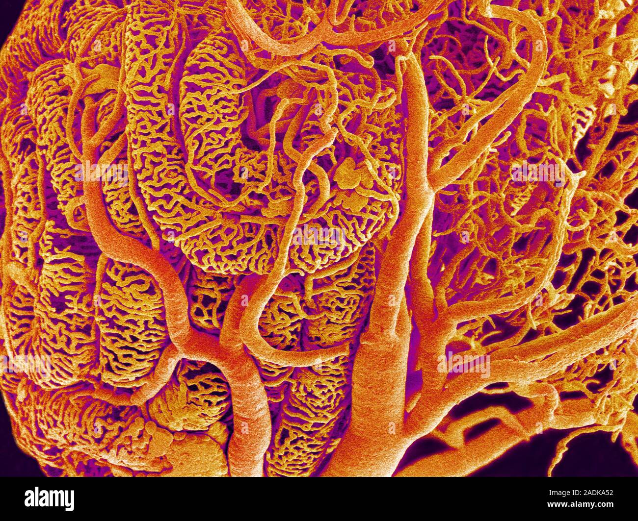 Blood vessels. Coloured scanning electron micrograph (SEM) of a resin ...