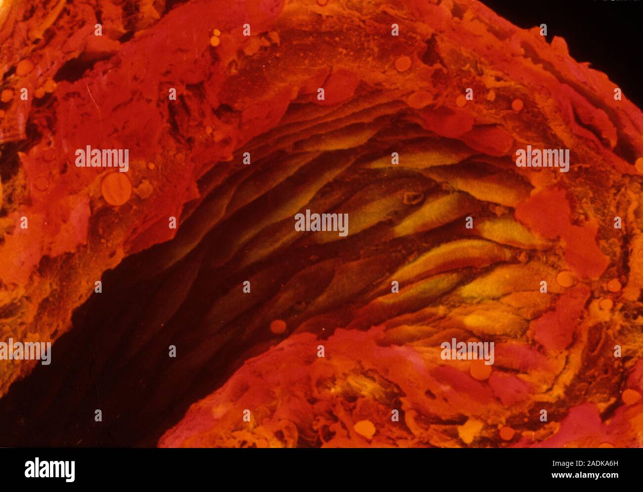 Arteriole. Coloured scanning electron micrograph (SEM) of a section ...