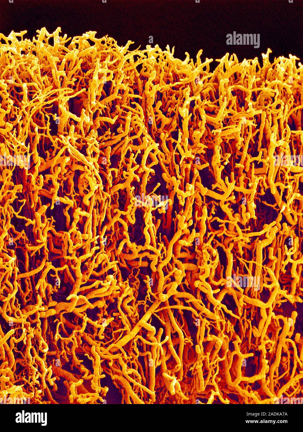 Blood vessels from the earlobe (pinna), coloured scanning electron