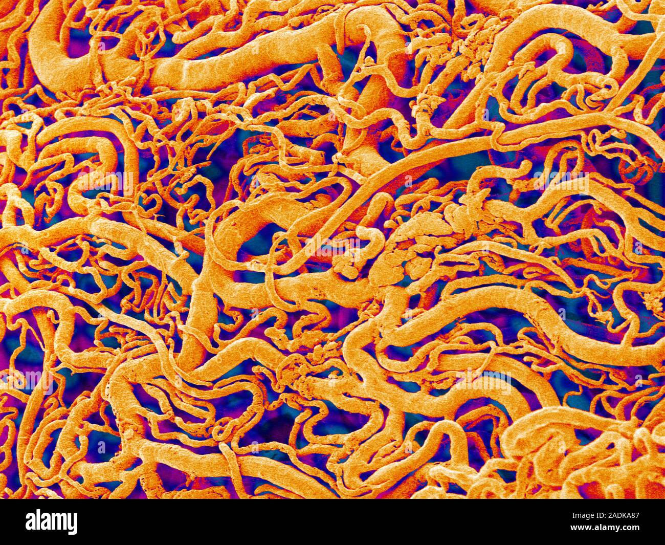 Blood vessel cast. Coloured scanning electron micrograph (SEM) of a ...