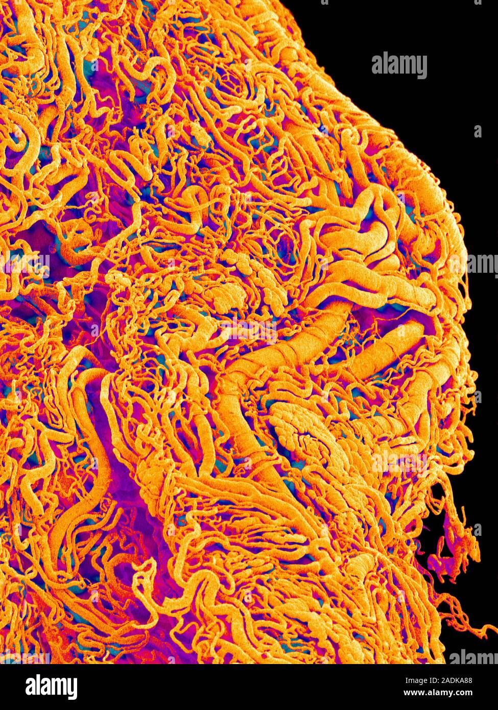 Blood vessel cast. Coloured scanning electron micrograph (SEM) of a ...