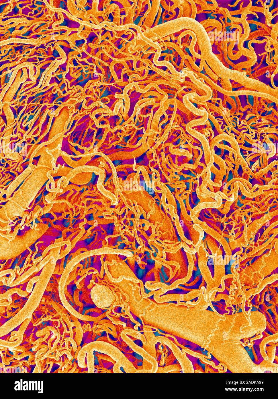 Blood vessel cast. Coloured scanning electron micrograph (SEM) of a ...