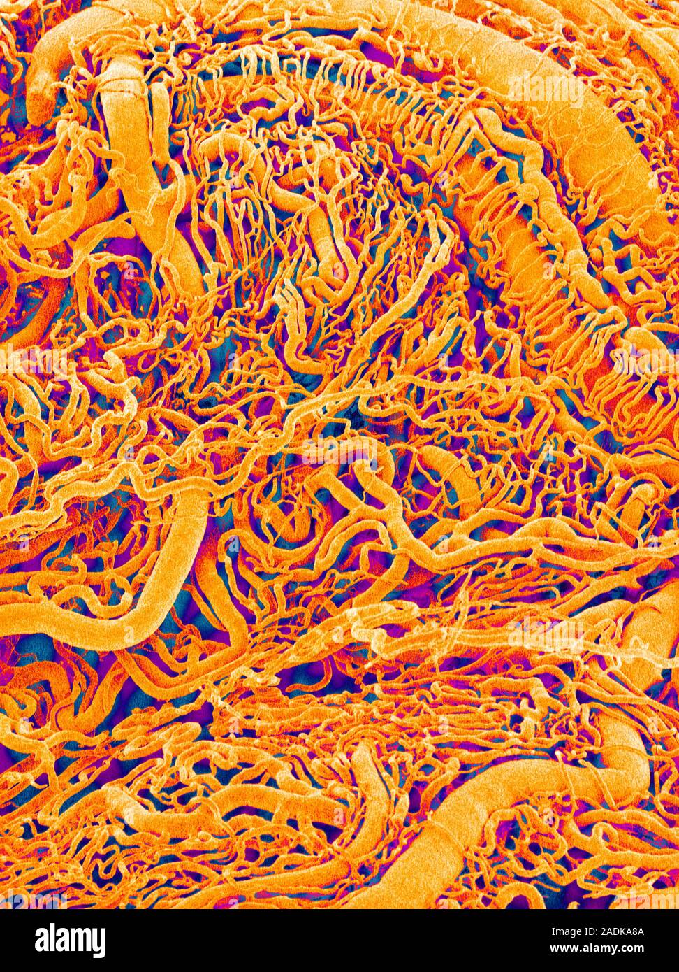 Blood vessel cast. Coloured scanning electron micrograph (SEM) of a ...