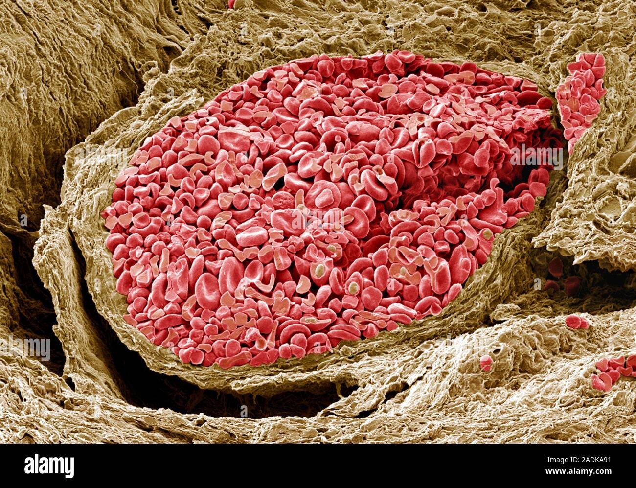 Foetal blood vessel. Coloured scanning electron micrograph (SEM) of a ...