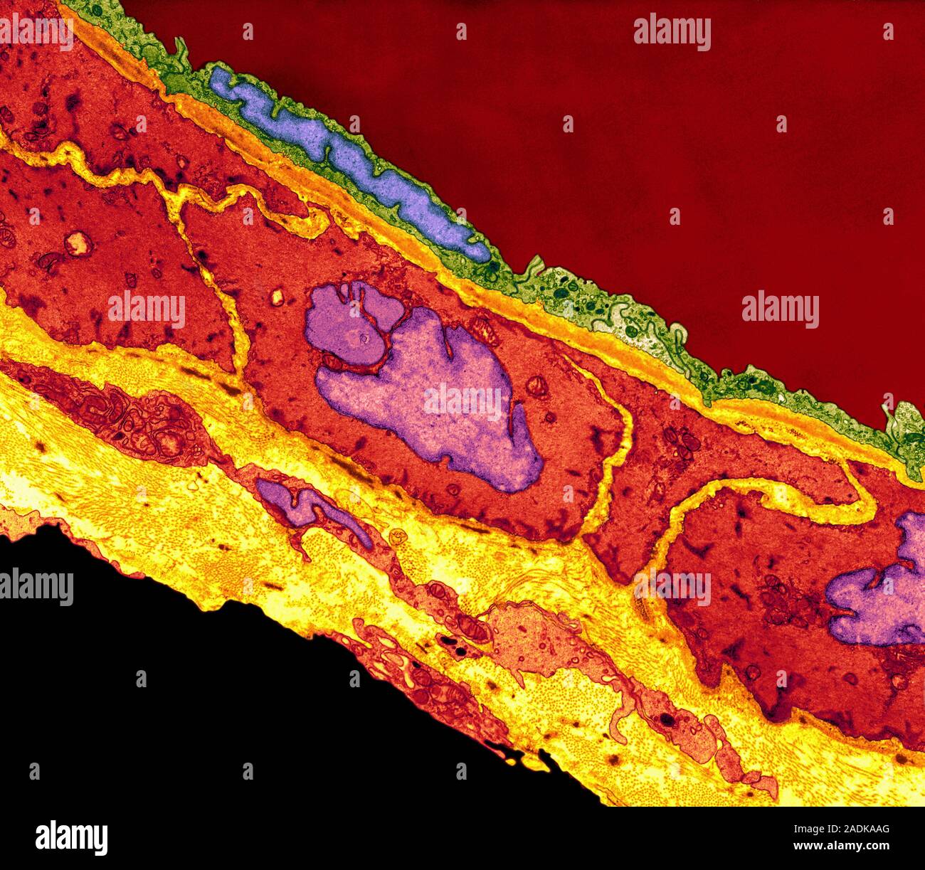 Coronary artery. Coloured transmission electron micrograph (TEM) of a ...