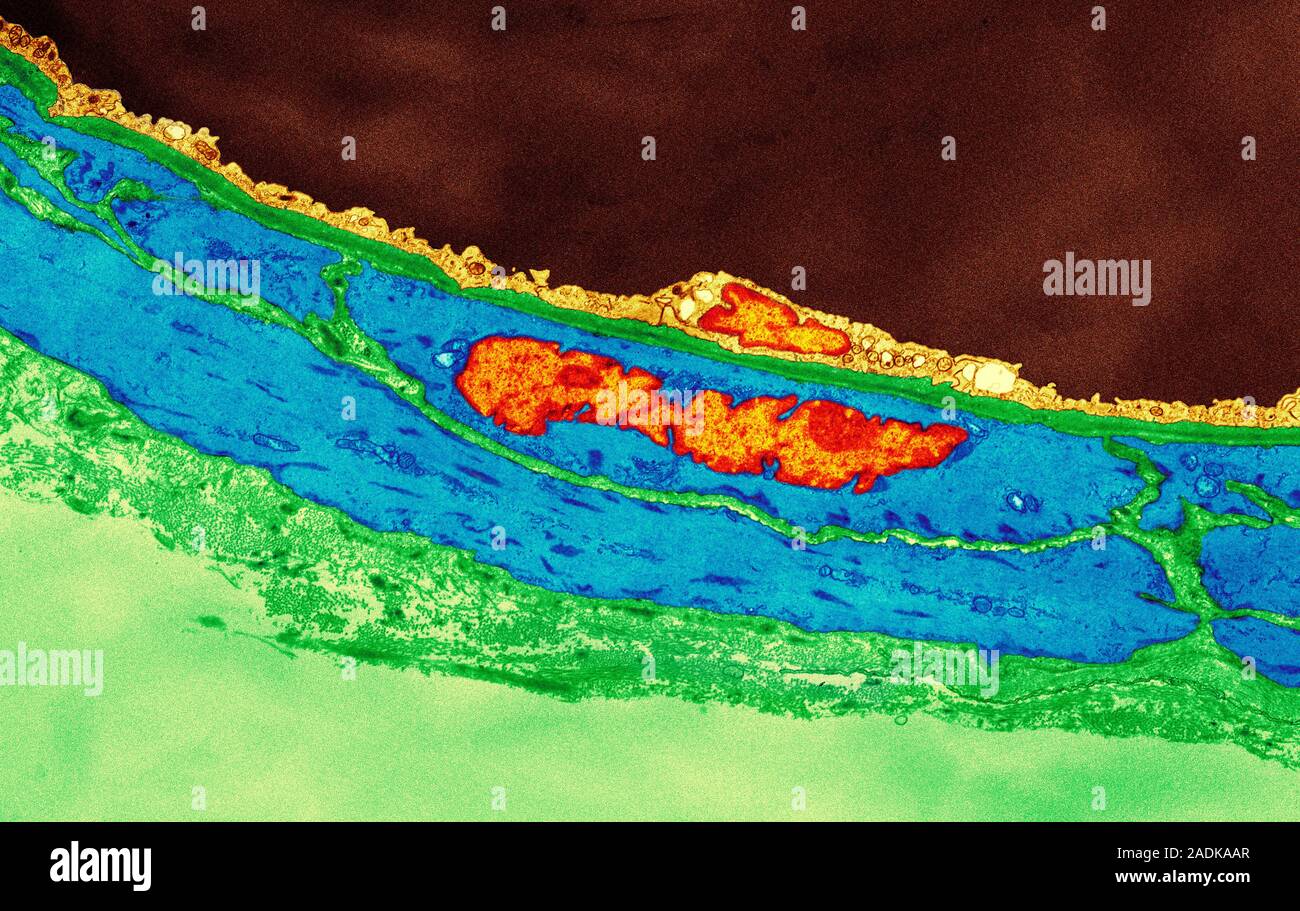 Coronary artery. Coloured transmission electron micrograph (TEM) of a ...