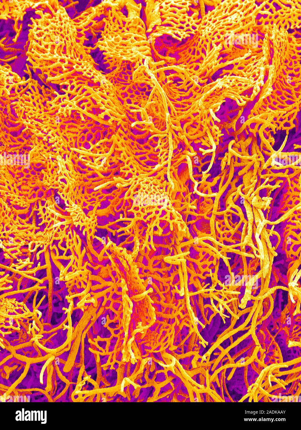 Liver blood vessels. Coloured scanning electron micrograph (SEM) of a ...