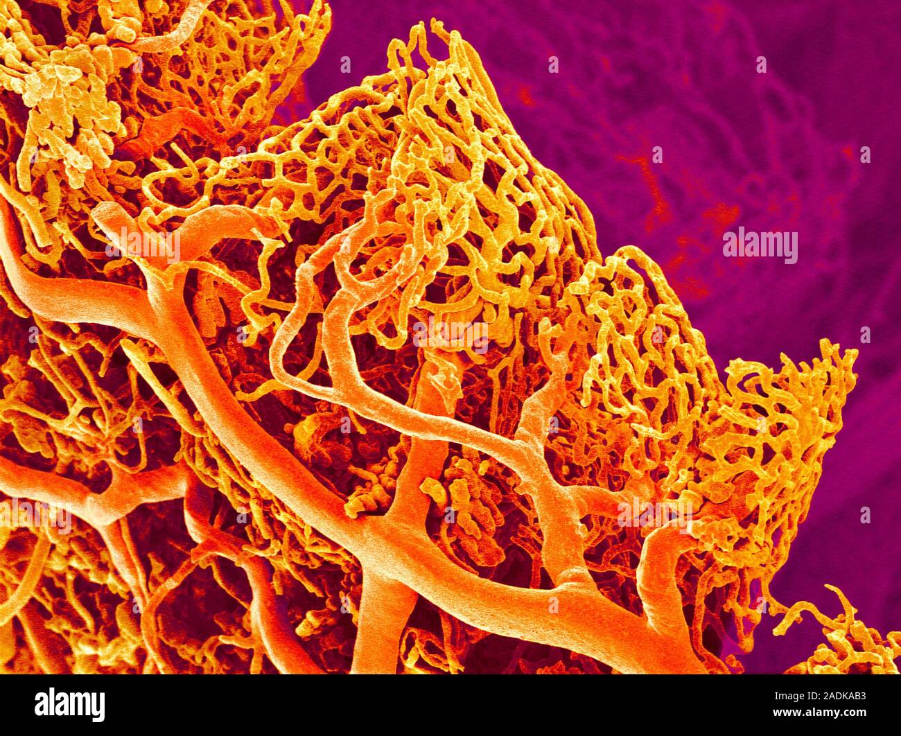 Blood vessels. Coloured scanning electron micrograph (SEM) of a resin ...