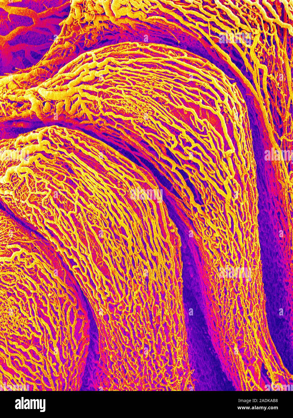 Nasal blood vessels. Coloured scanning electron micrograph (SEM) of a ...