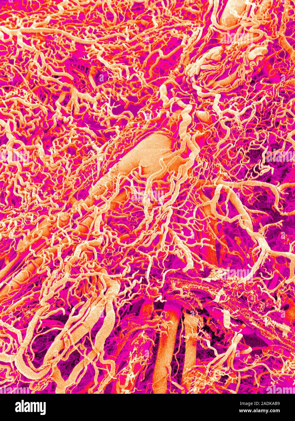 Blood vessels. Coloured scanning electron micrograph (SEM) of a resin ...