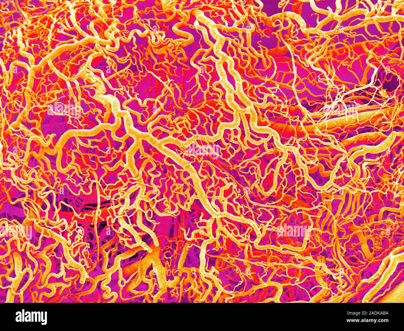 Blood vessels. Coloured scanning electron micrograph (SEM) of a resin ...