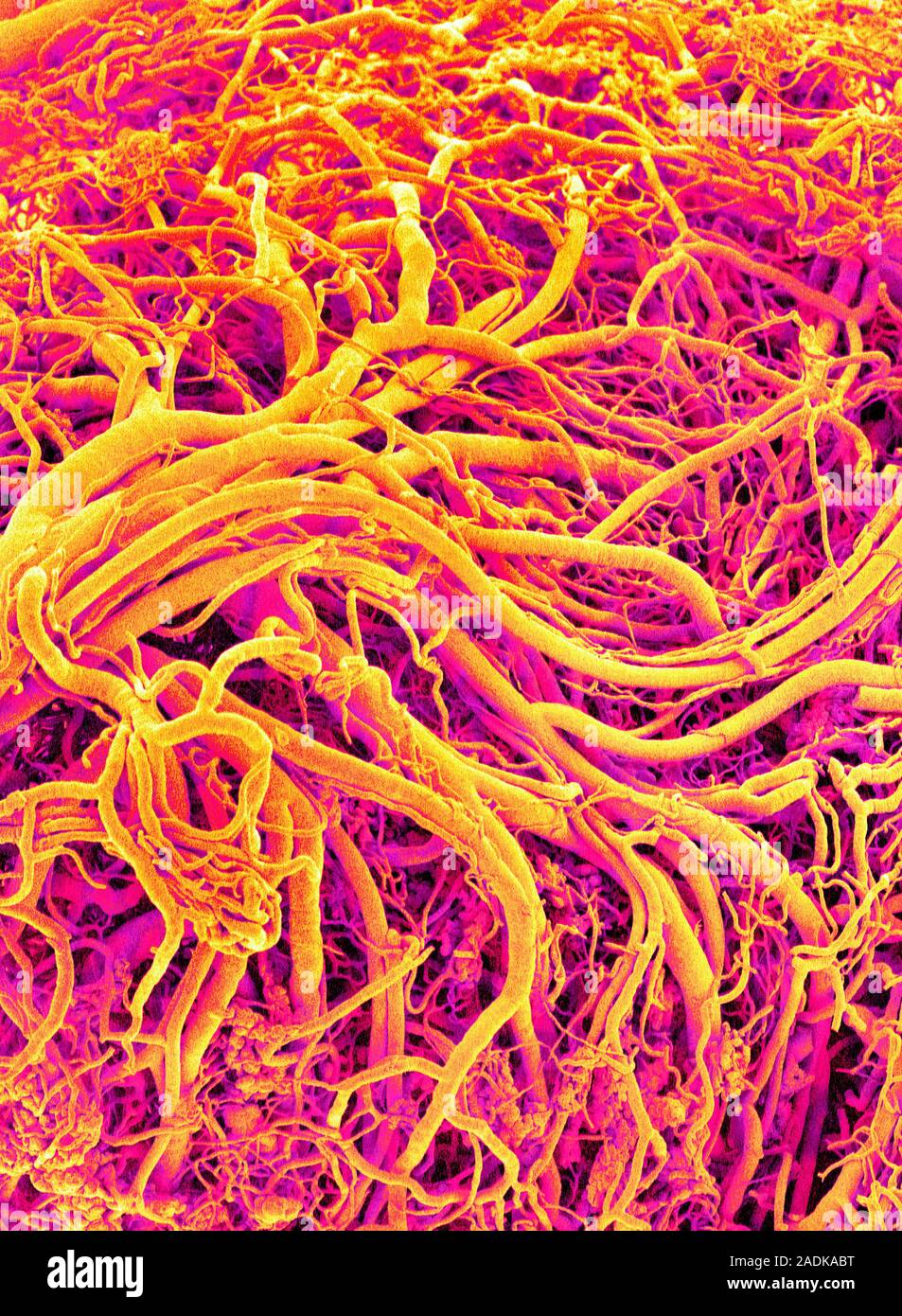 Blood vessels. Coloured scanning electron micrograph (SEM) of a resin ...