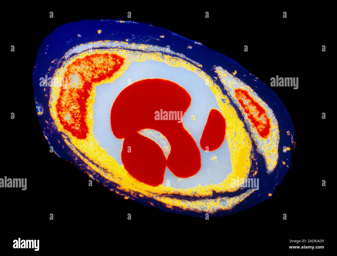 Blood capillary. Coloured transmission electron micrograph of a section ...
