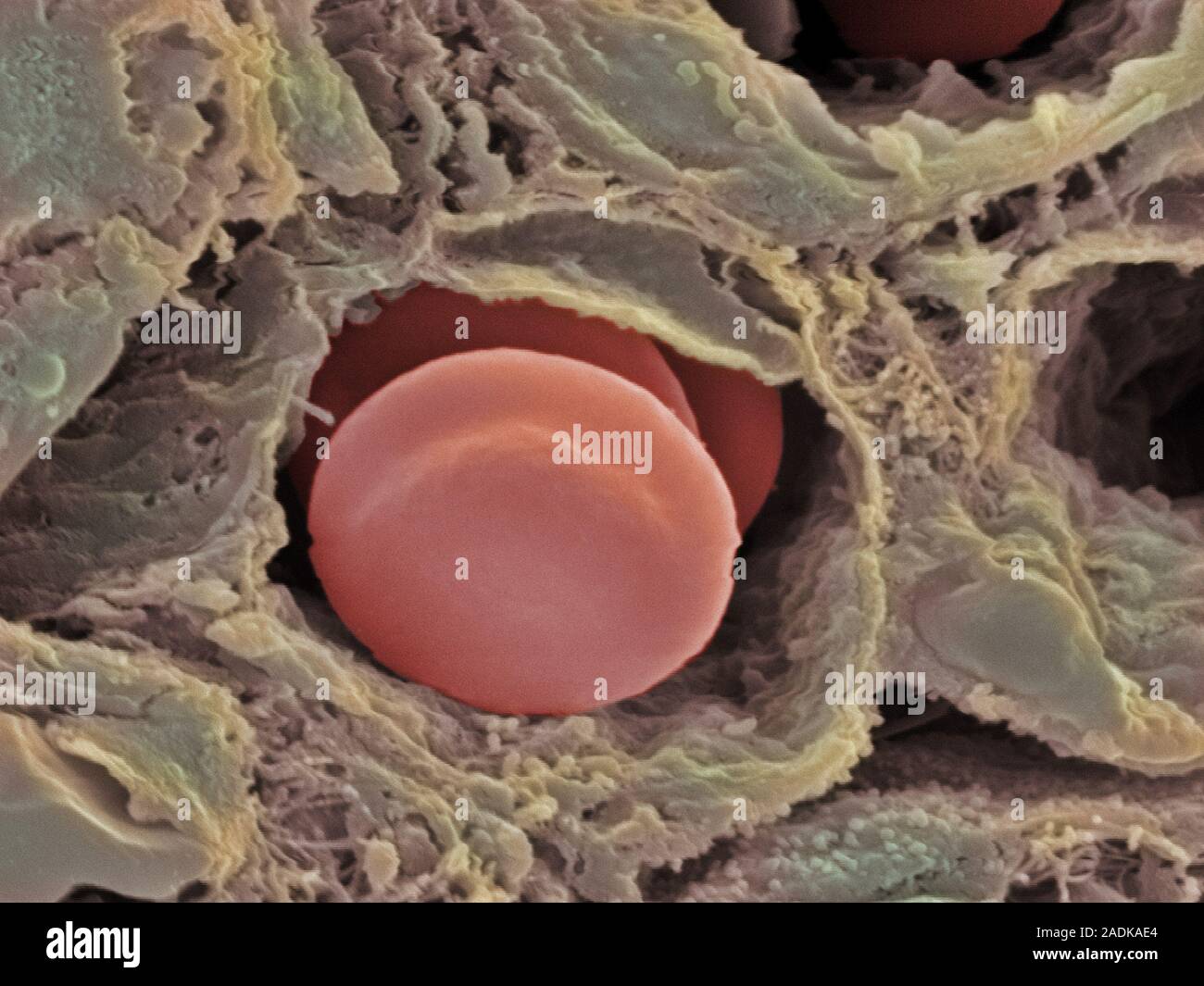 Capillary. Coloured scanning electron micrograph (SEM) of a section ...
