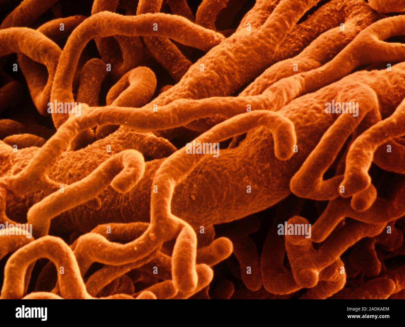 Capillaries. Coloured scanning electron micrograph of a network of ...