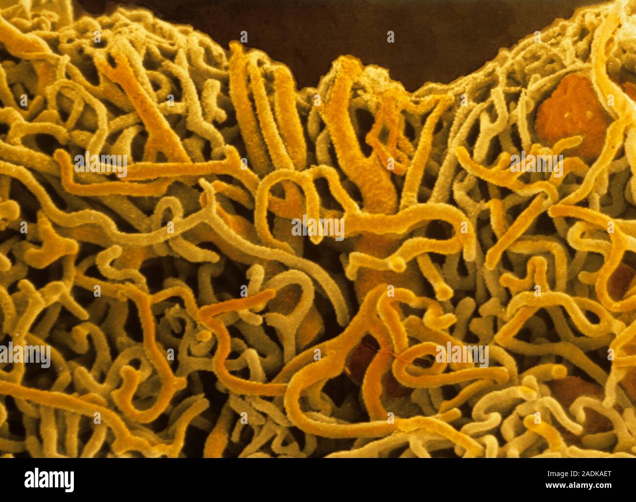 Capillaries. Coloured scanning electron micrograph of a network of ...