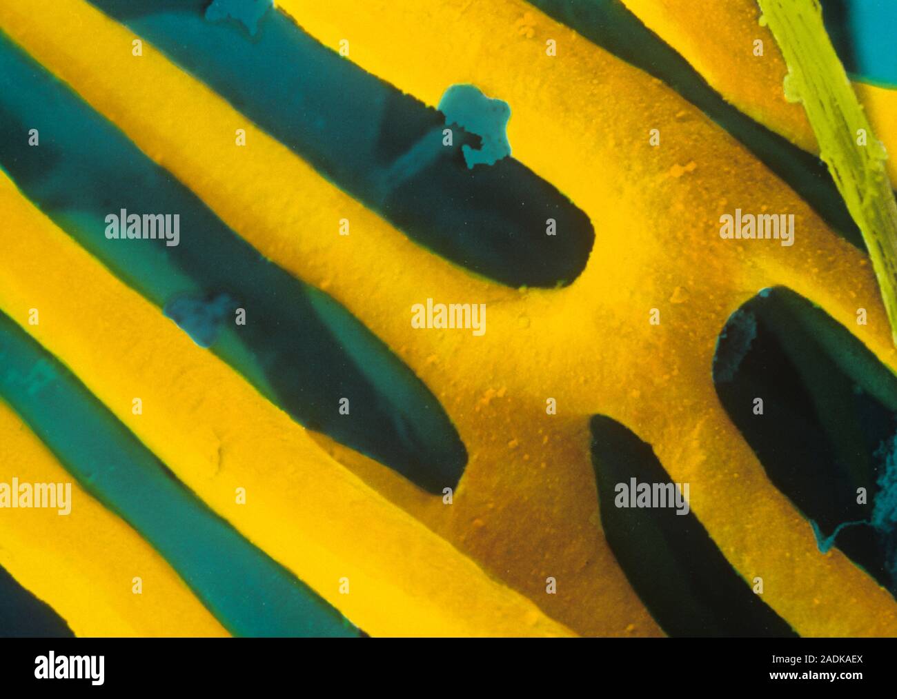 Capillaries. Coloured scanning electron micrograph (SEM) of a network ...