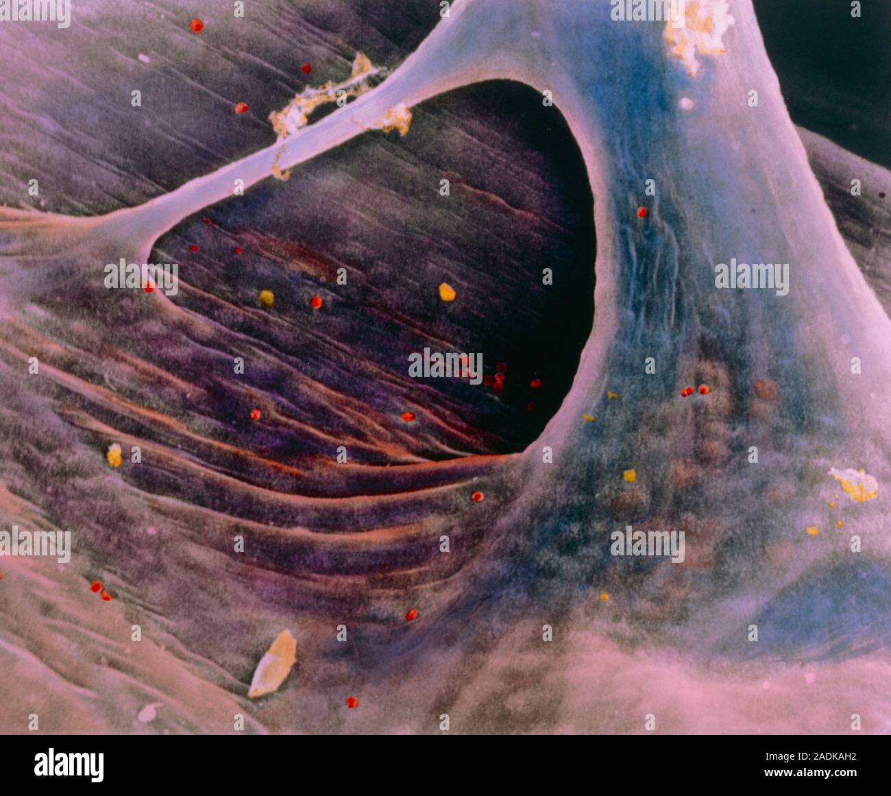 False-colour scanning electron micrograph (SEM) of the endocardium, the ...