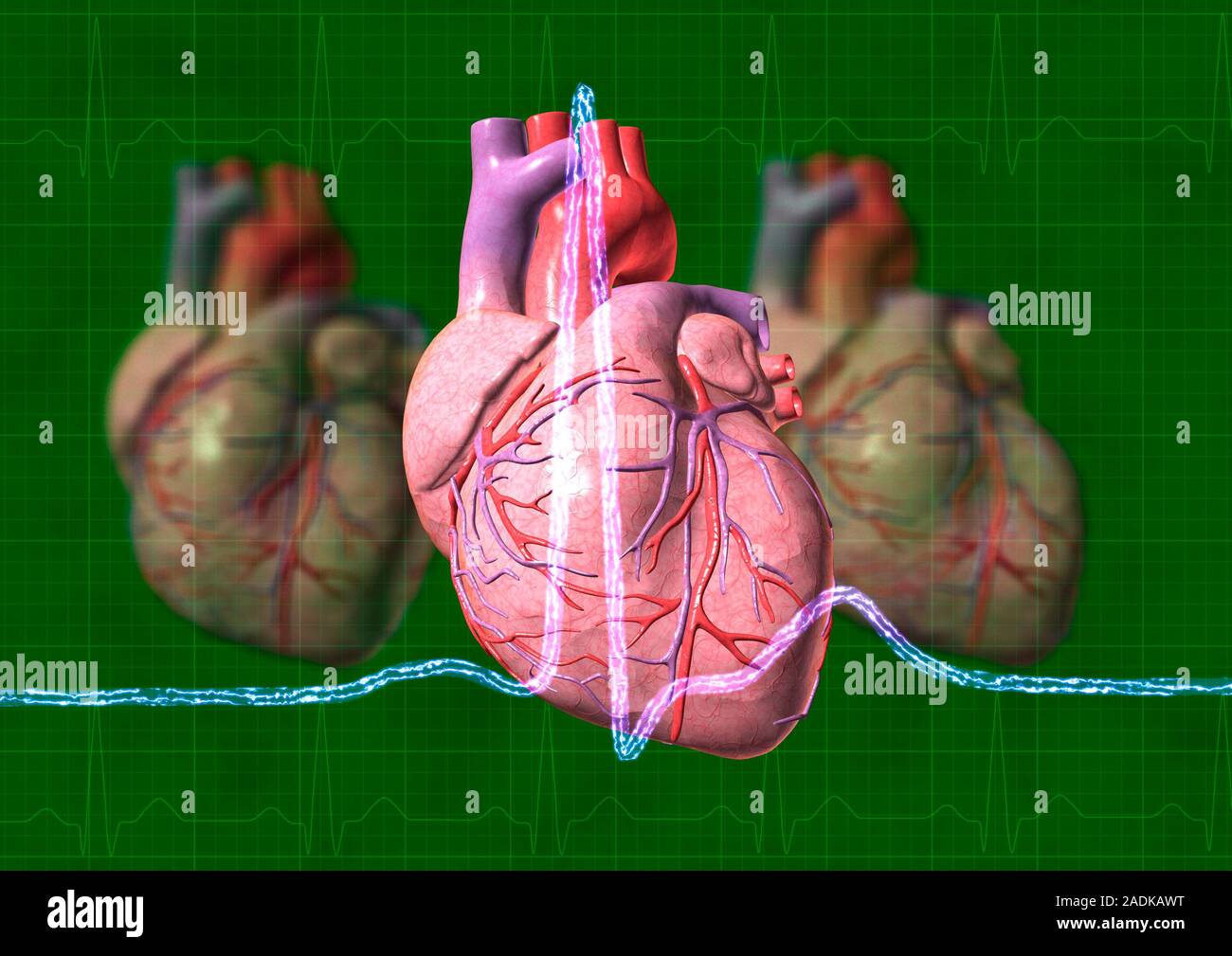 Heart. Computer artwork of three hearts and electrocardiogram (ECG ...
