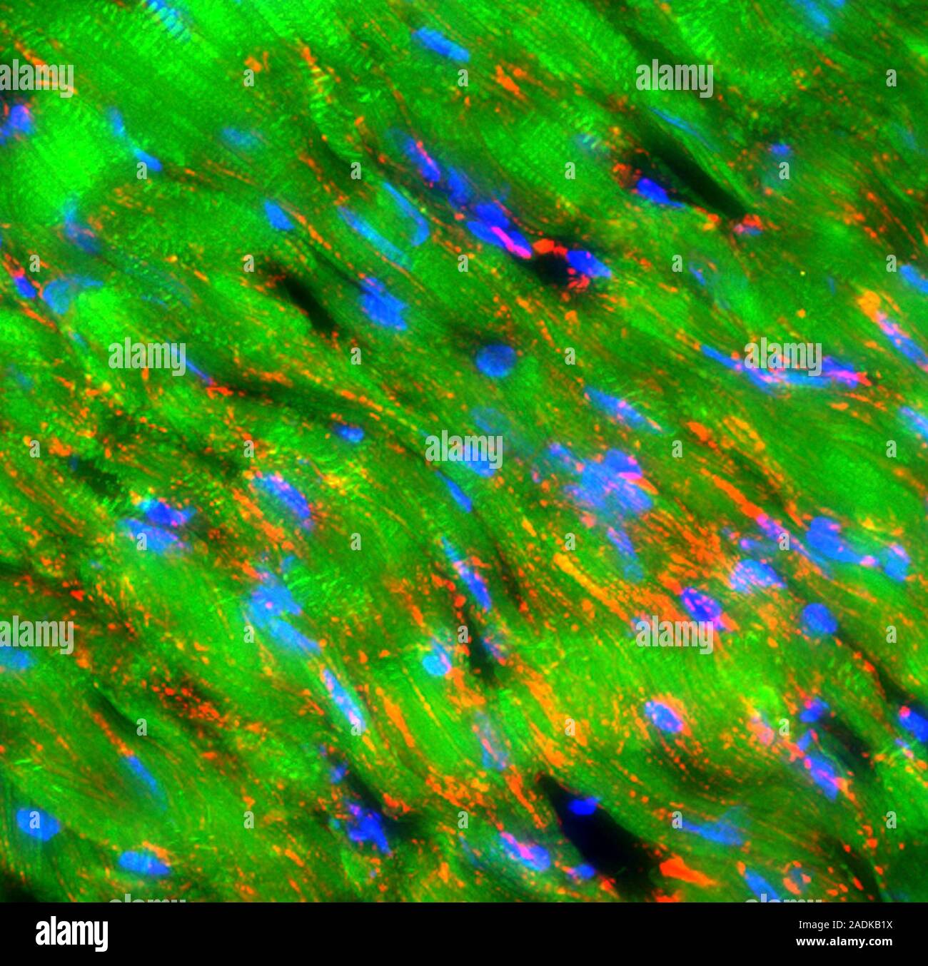 Heart muscle cells, fluorescence deconvolution micrograph. Fluorescent