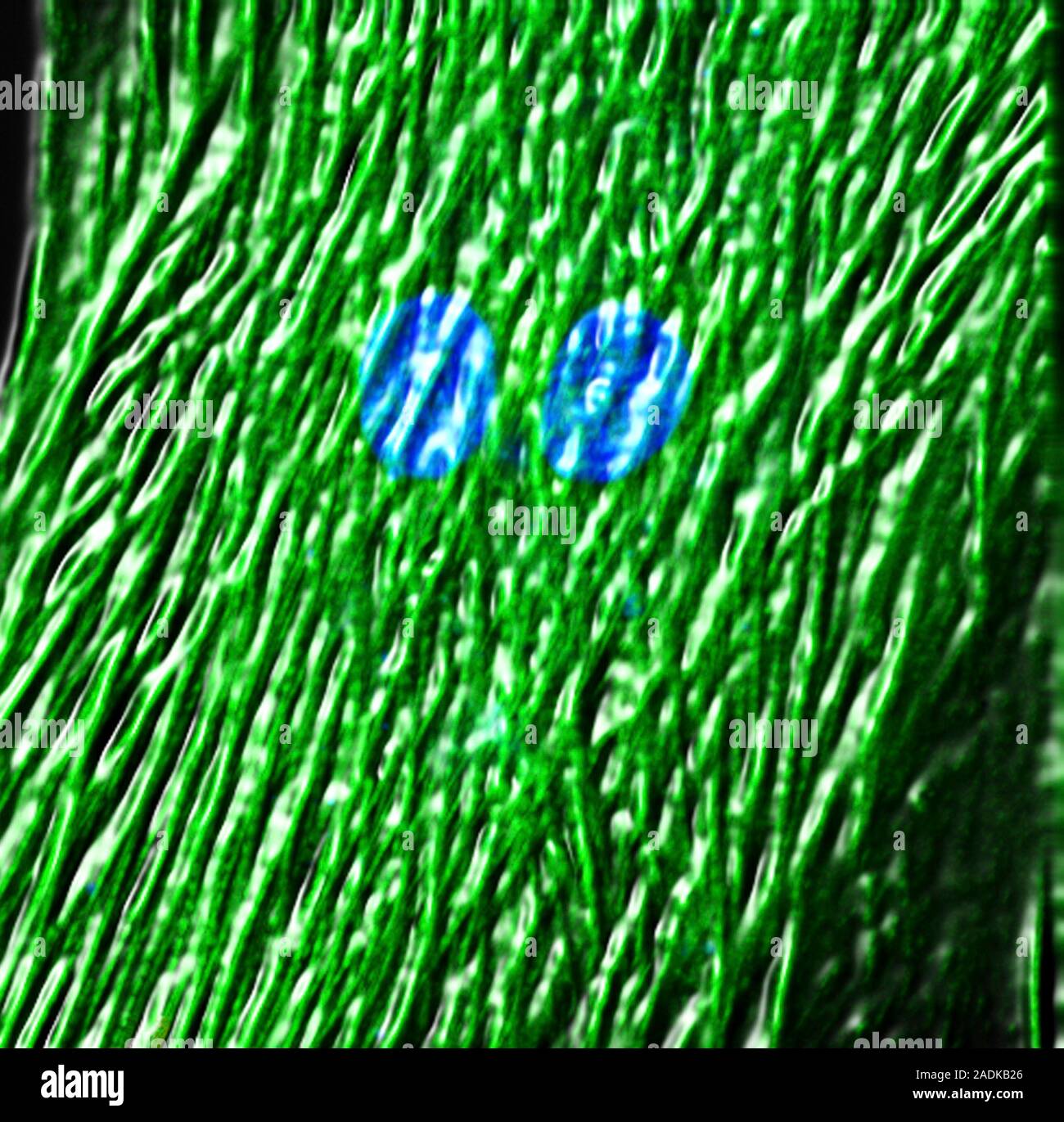 Cardiac cell differentiation, fluorescence deconvolution micrograph