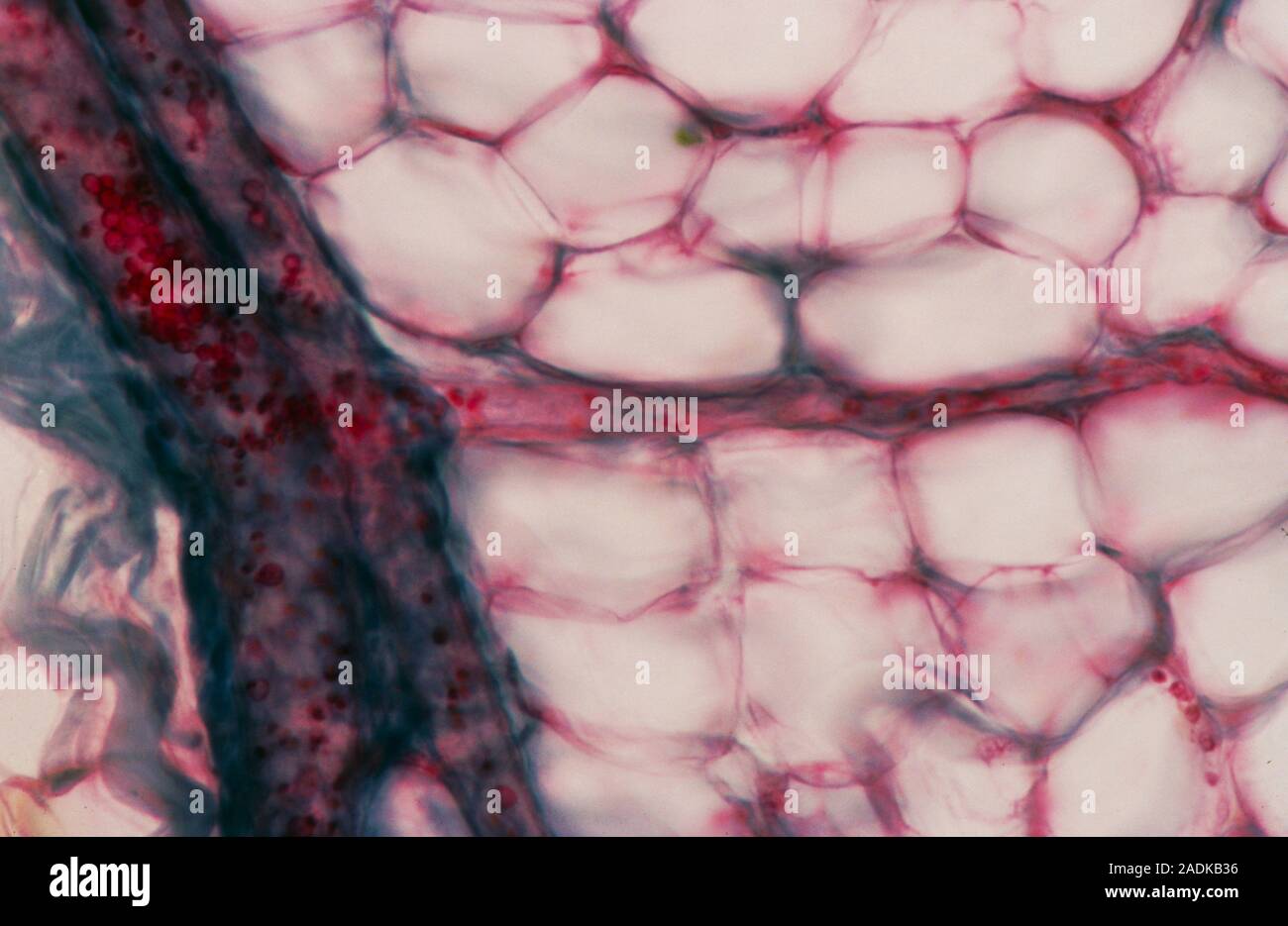 Light micrograph of a blood vessel with branching capillary and connective tissue (white ovals). Stock Photo