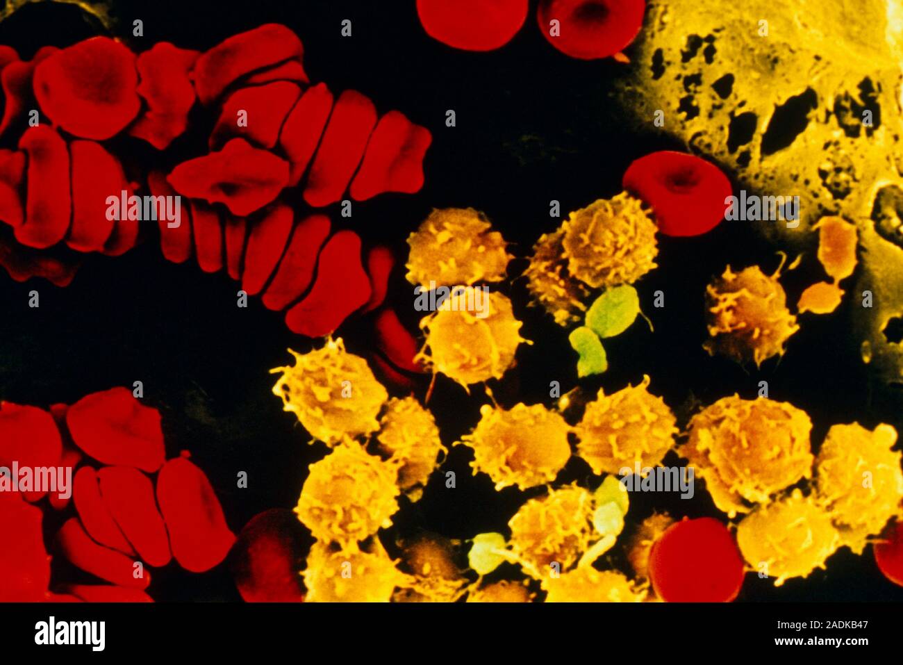 Bone marrow. Coloured scanning electron micrograph of immature red and