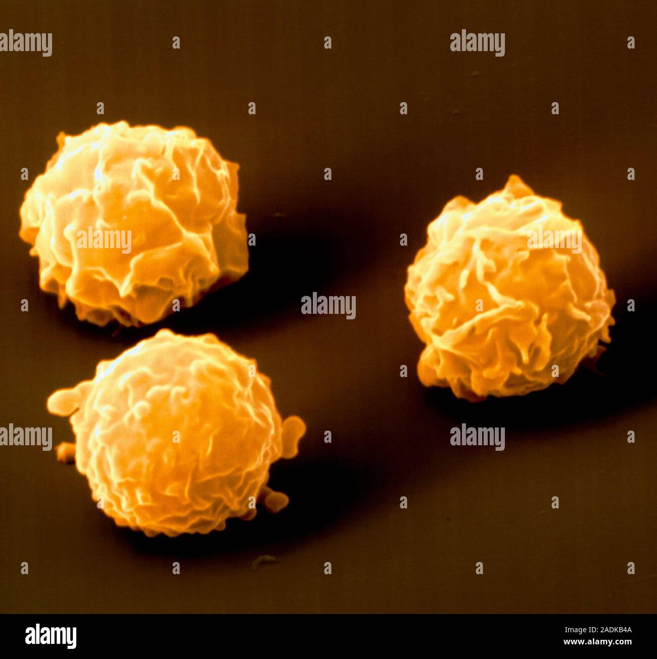 Bone marrow. Coloured Scanning Electron Micrograph (SEM) of human bone marrow stem cells. These