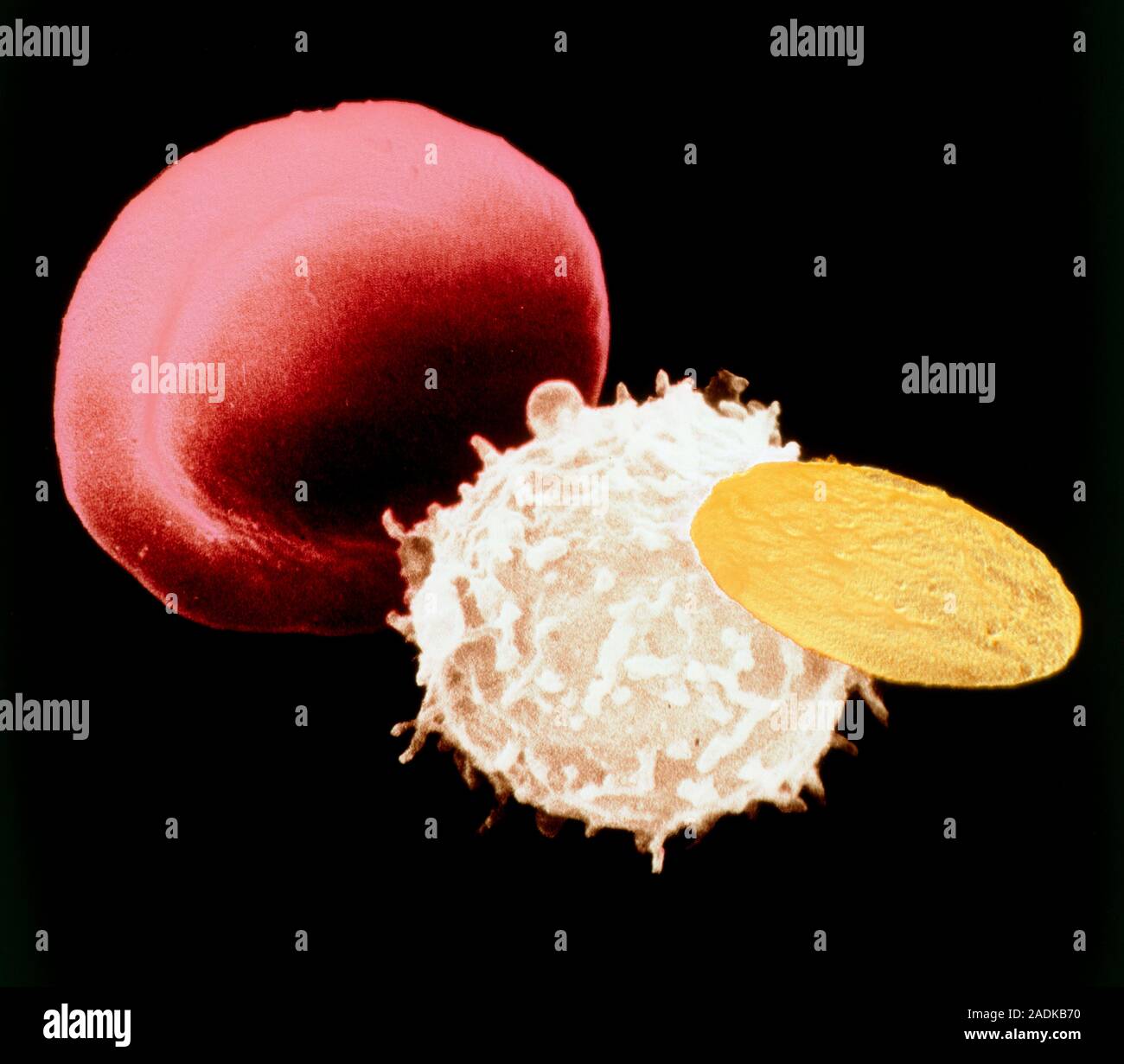 False-colour scanning electron micrograph (SEM) of three types of cells ...