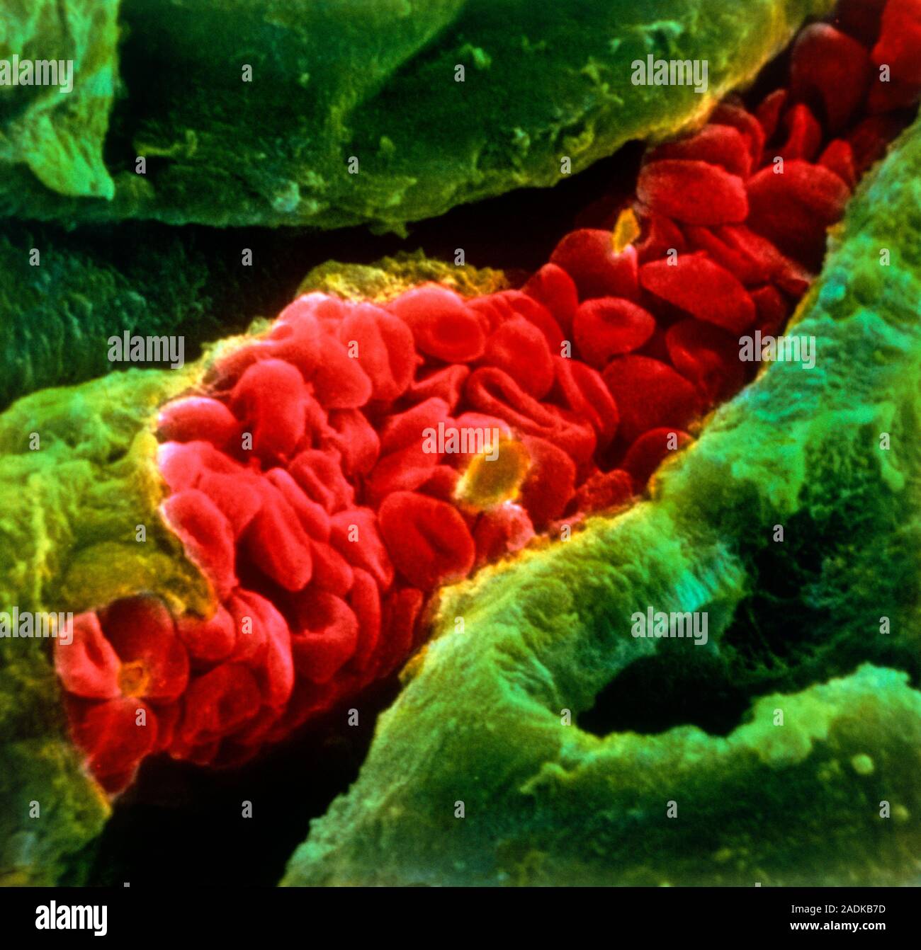 False-colour scanning electron micrograph (SEM) of red blood cells ...