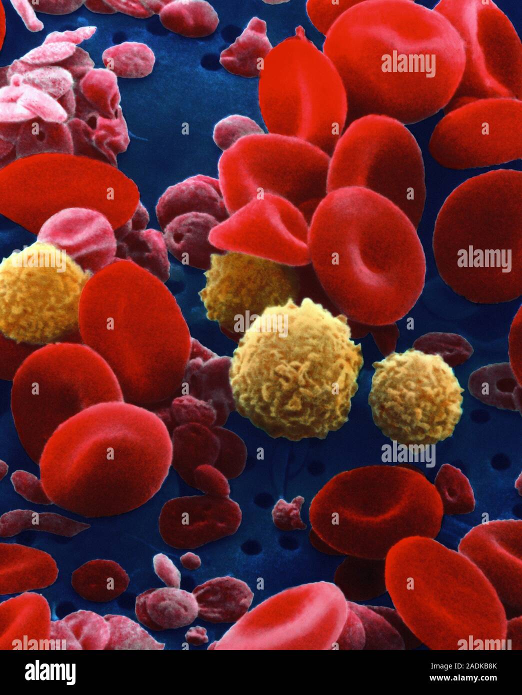 Blood cells and platelets. Coloured Scanning Elec tron micrograph (SEM