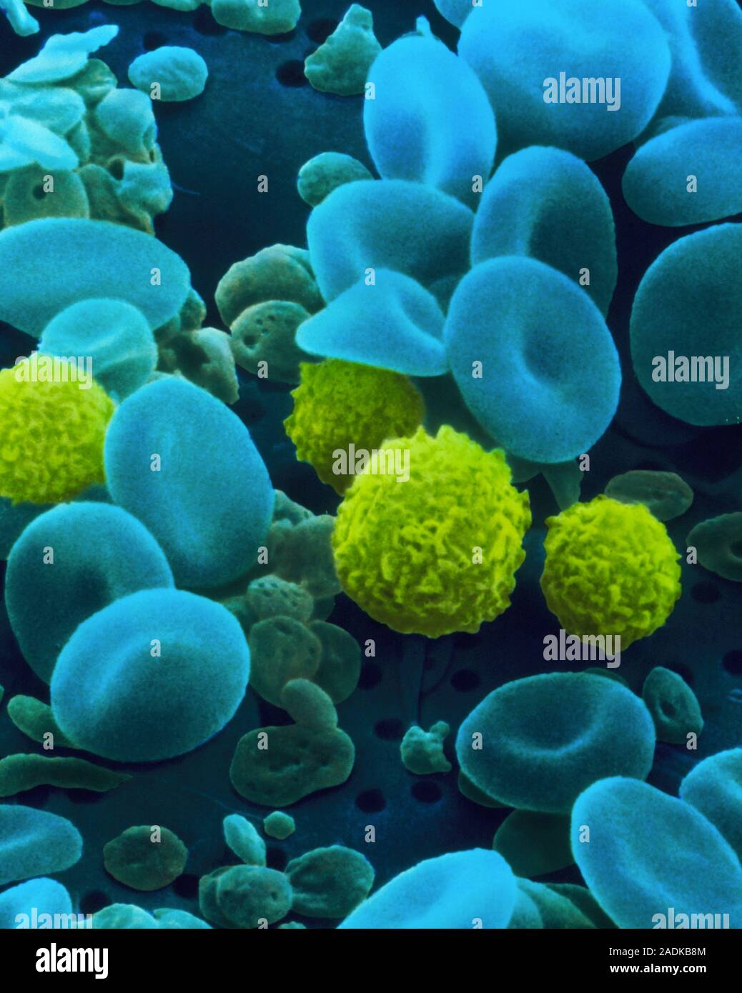 Blood cells and platelets. Coloured Scanning Elec tron micrograph (SEM