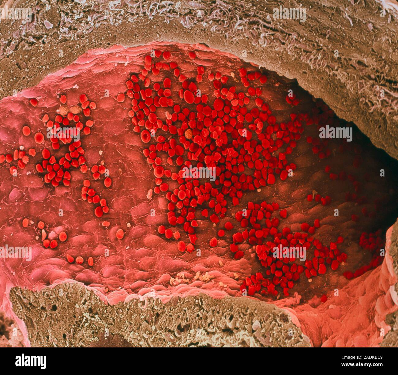 Red blood cells. Coloured scanning electron micrograph (SEM) of a ...