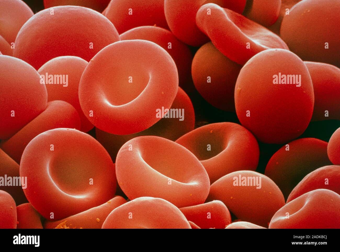 Red blood cells. Coloured scanning electron micrograph (SEM) of red blood cells or erythrocytes