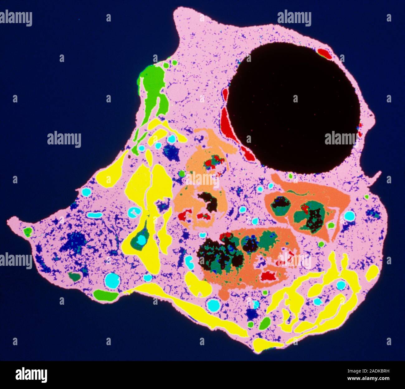 Apoptosis. Coloured transmission electron micrograph (TEM) of a human ...