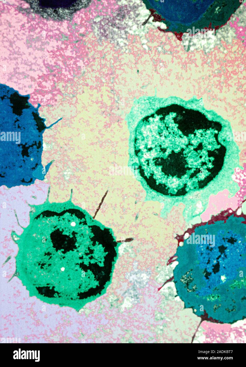 White blood cells. Coloured transmission electron micrograph (TEM) of a ...