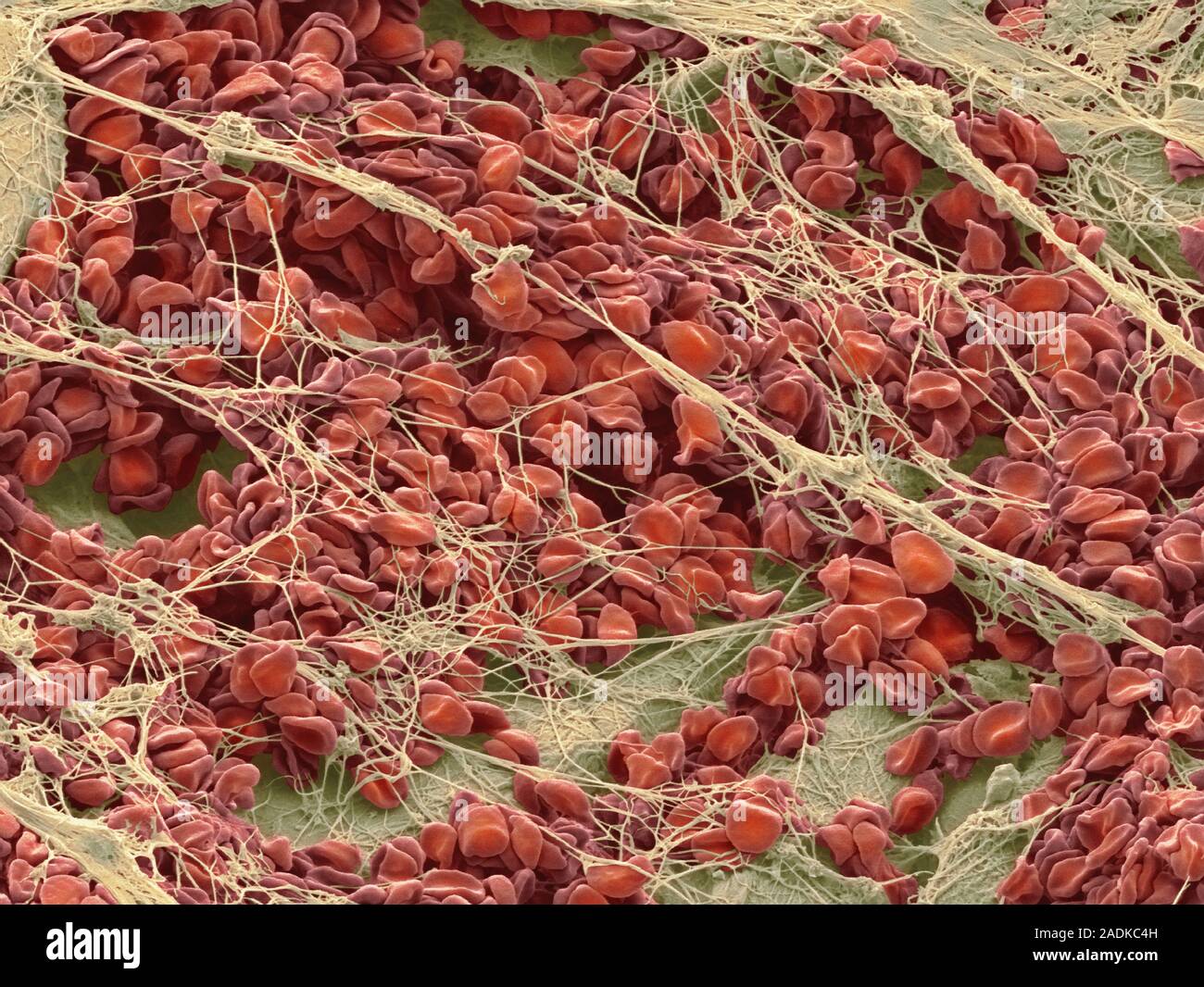 фибрин капилляры