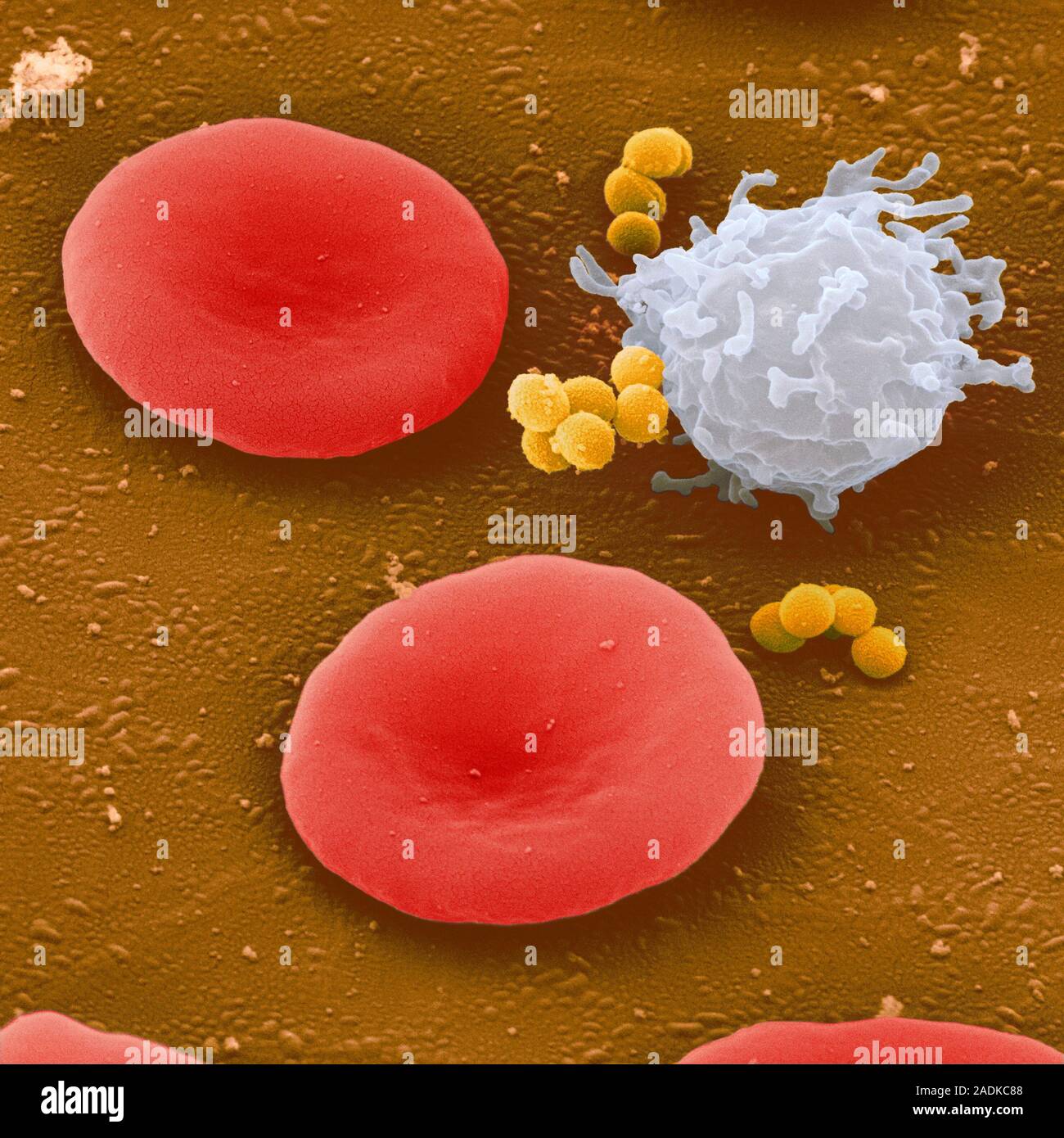Эритроциты макрофаги. Эритроциты фагоциты лейкоциты. Лейкоциты фагоцитоз микрофото. Иммунитет фагоциты. Лейкоциты под микроскопом.