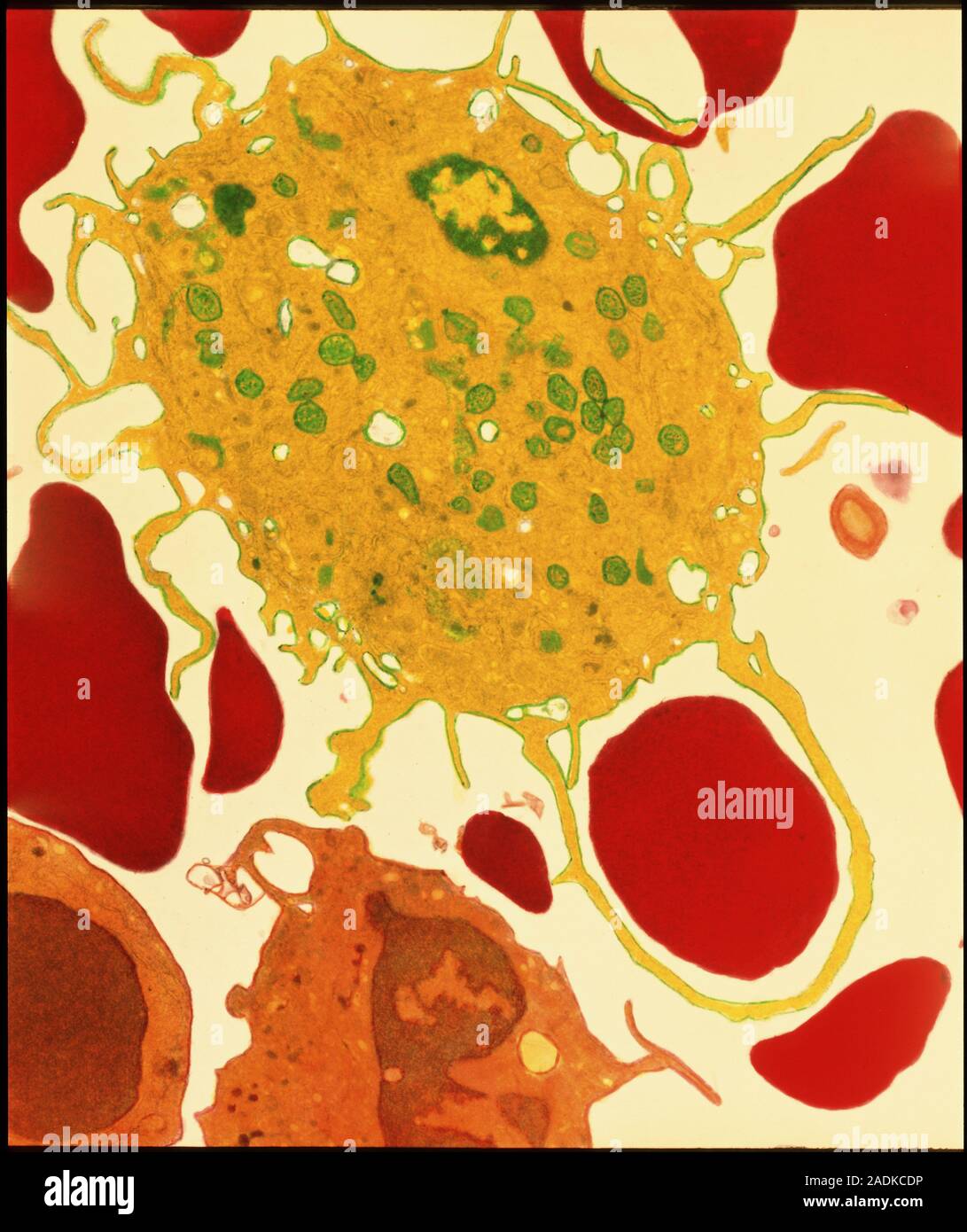 Macrophage eating red blood cell.b Coloured transmission electron ...