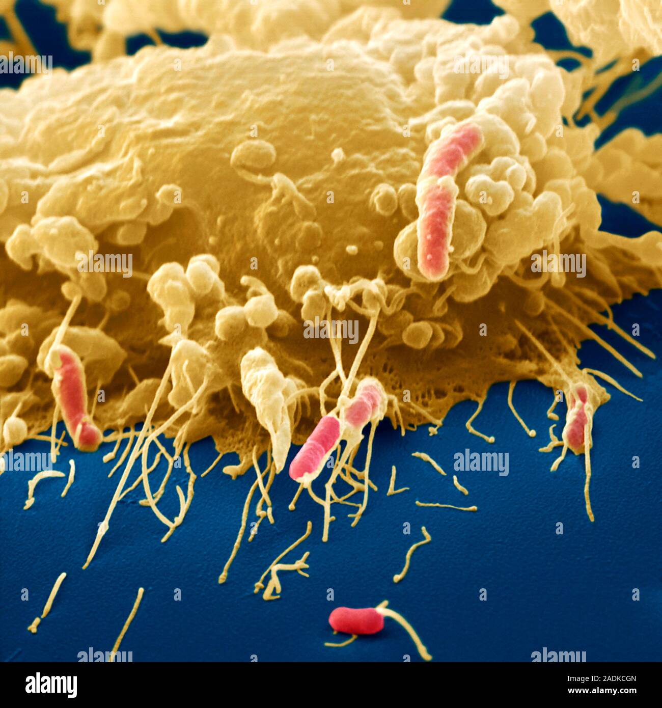 какие лейкоциты пожирают микробов. какие лейкоциты пожирают микробов. макрофаг и фагоцит фагоцит. лейкоциты атакуеь вирусы. макрофаги это лейкоциты.