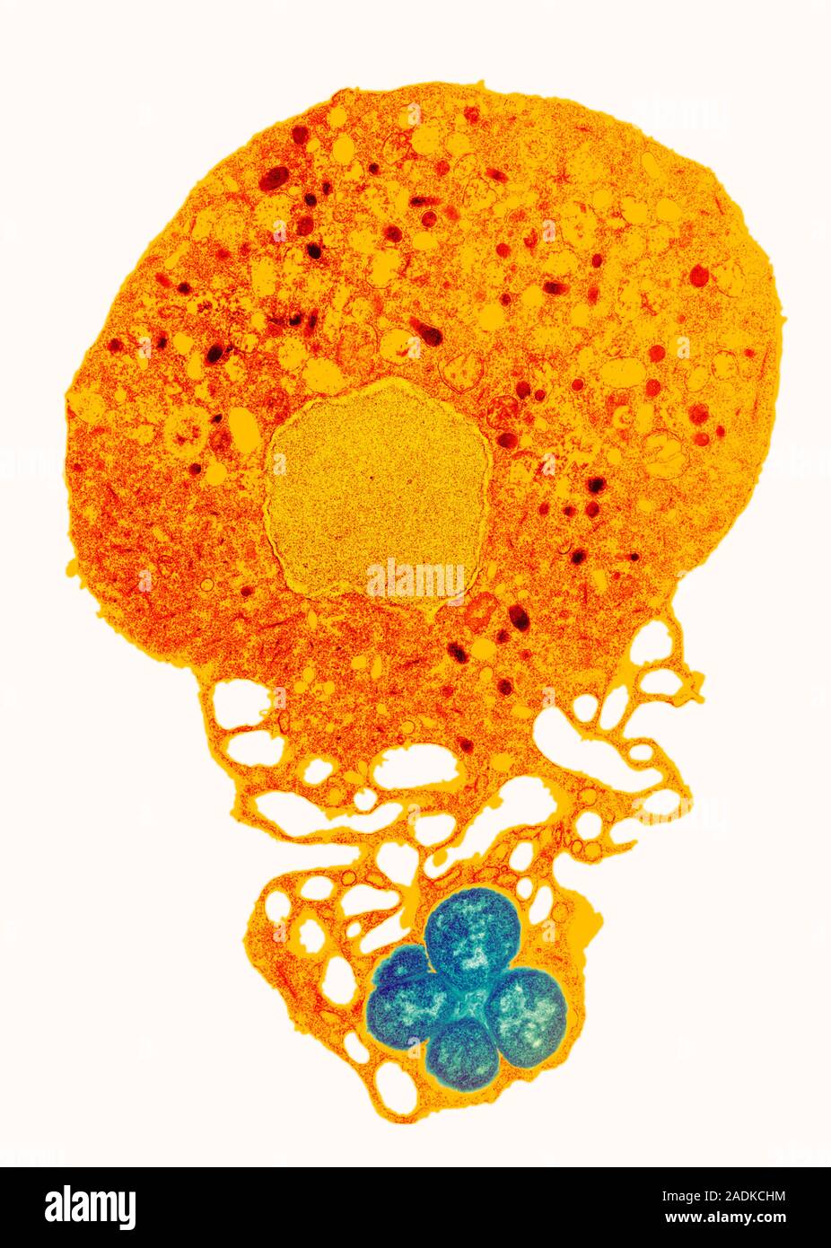 Neutrophil and trapped bacteria. Coloured transmission electron ...