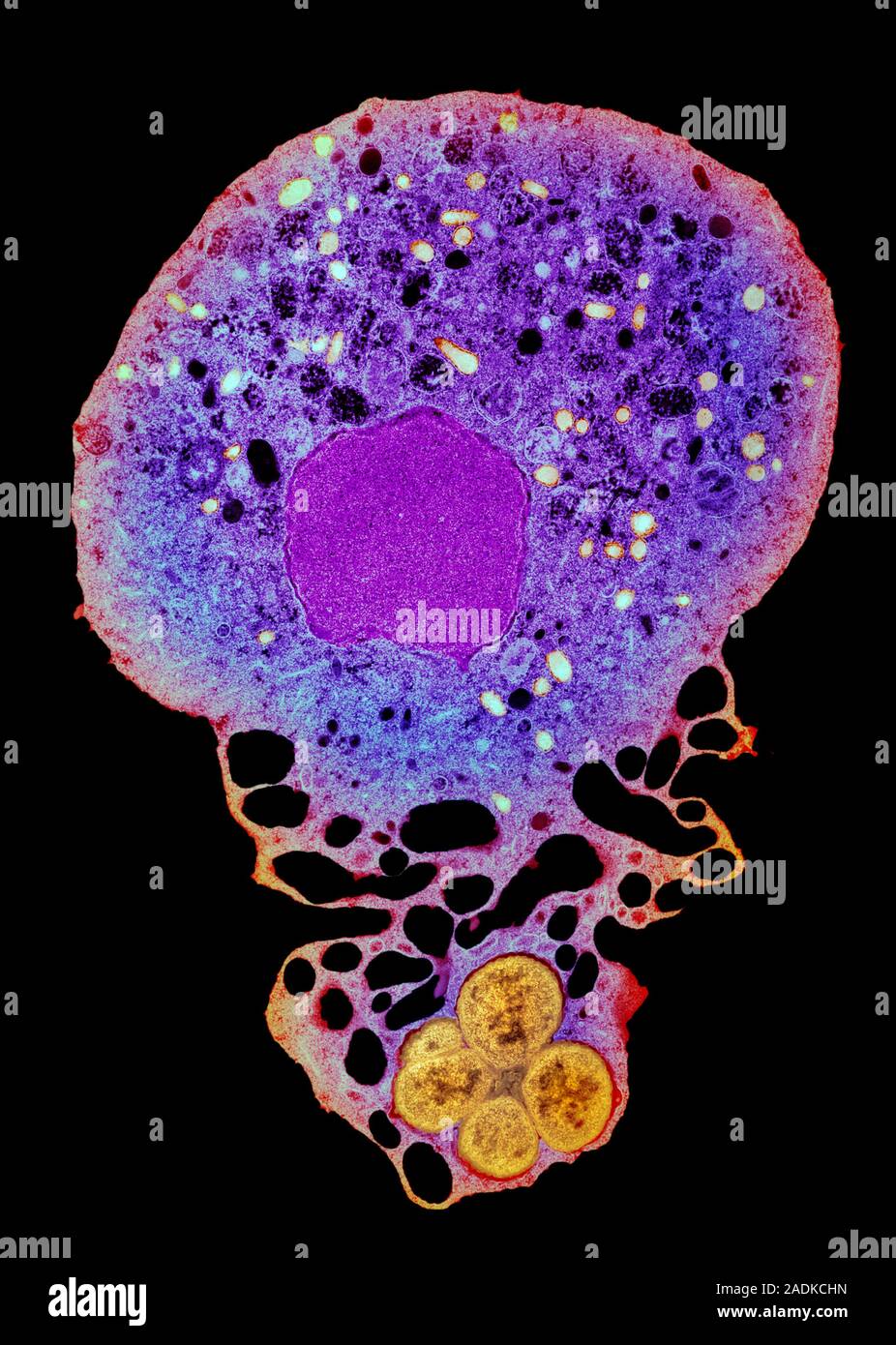 Trapped Germs Neutrophil and trapped bacteria. Coloured transmission electron ...