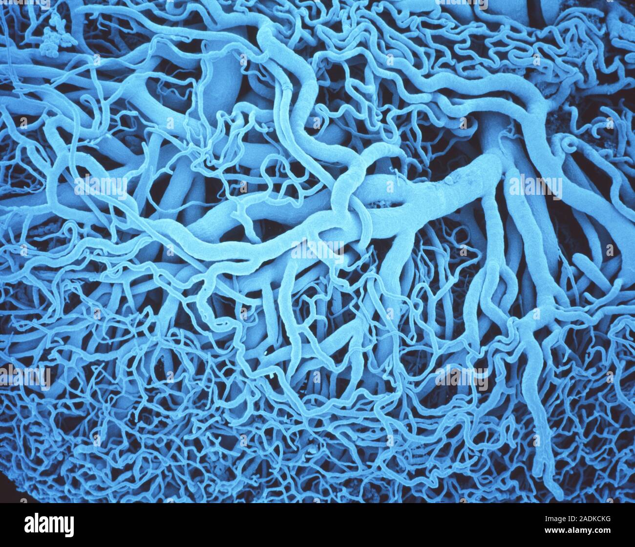 Воды сосуды человека. Капилляры под микроскопом. Капилярии под микроскопом. Кровеносные сосуды под микроскопом.