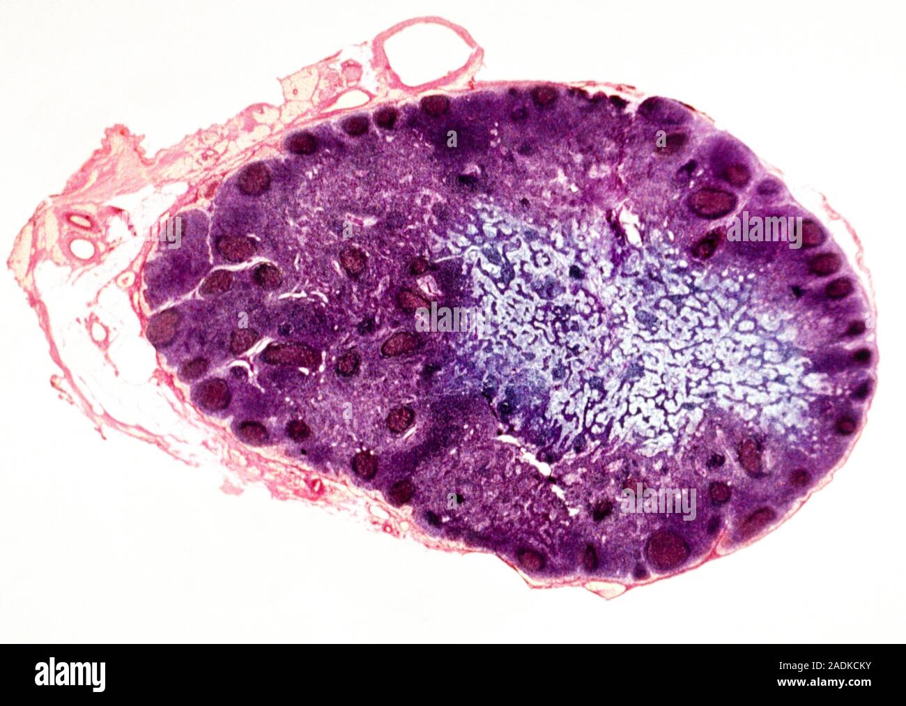 Lymph Node Coloured Light Micrograph Of A Section Through A Lymph Node